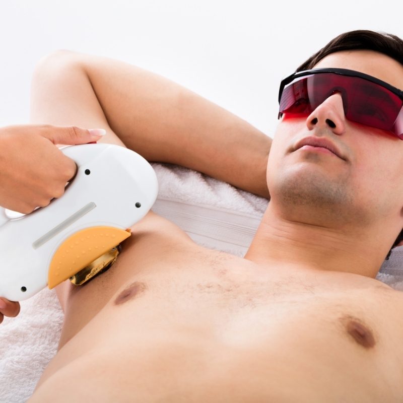 Unwanted hair removal for men